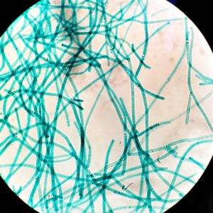 സയനോ ബാക്റ്റീരിയങ്ങൾ (കടപ്പാട് : https://commons.wikimedia.org/wiki/File:Tolypothrix_(Cyanobacteria).JPG)